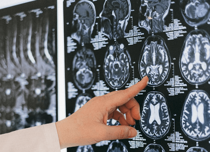 Koci pasożyt może pomóc w leczeniu chorób mózgu